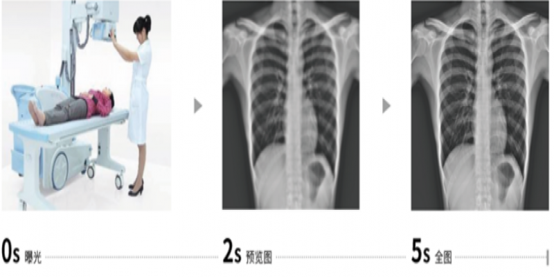 <span style=''>醫(yī)用X-RAY設(shè)備用于新冠狀肺炎，堅(jiān)決打贏抗疫阻擊戰(zhàn)！</span>